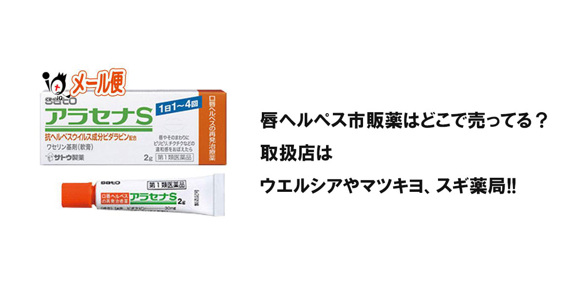 唇ヘルペス市販薬はどこで売ってる？取扱店はウエルシアやマツキヨ、スギ薬局!!